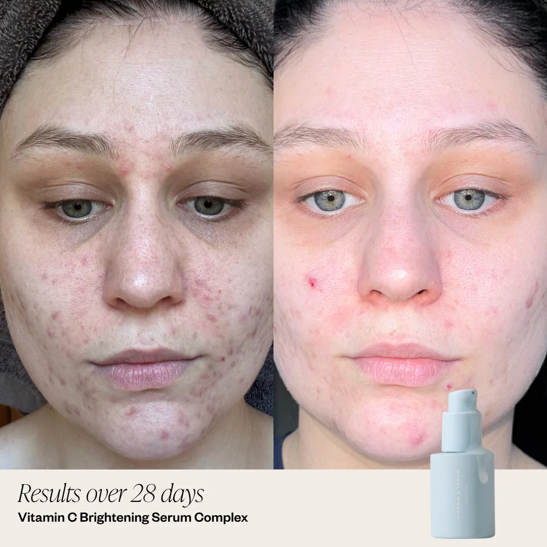 Brightening System - Trial Size - Image 3