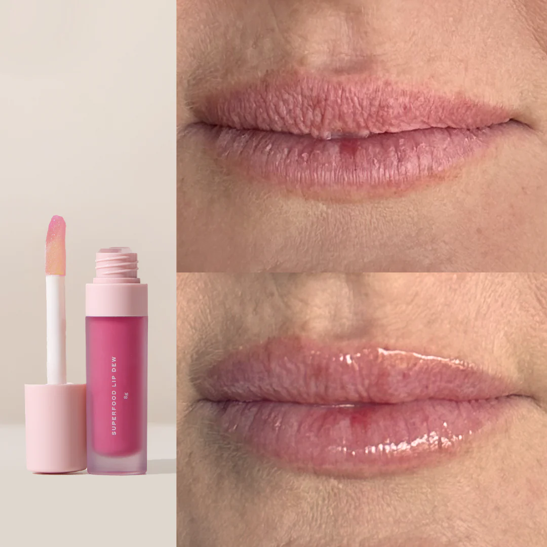 Superfood Lip Dew + Plump Shot - Image 4