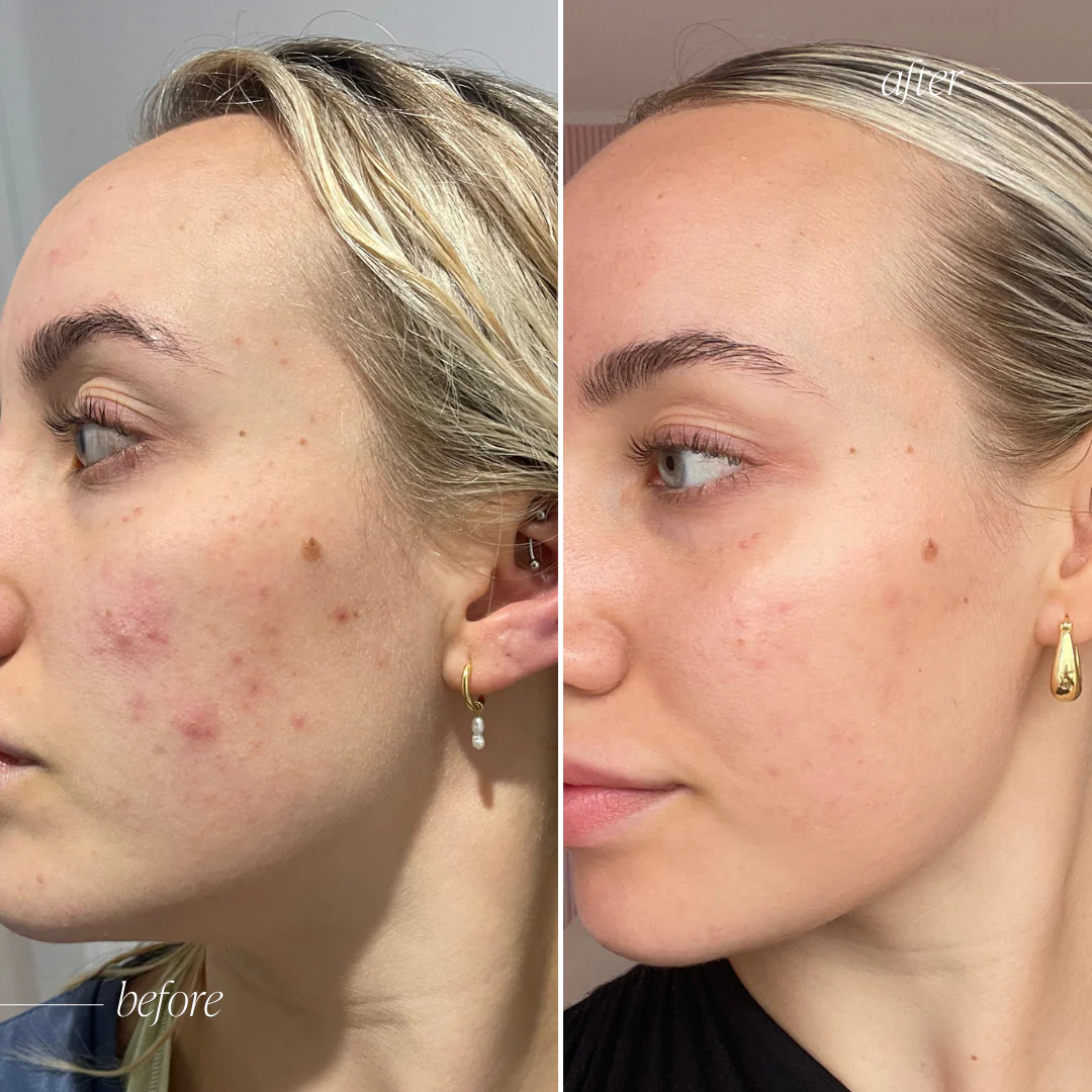 Original Formula - Probiotic Moisturiser + - Image 4