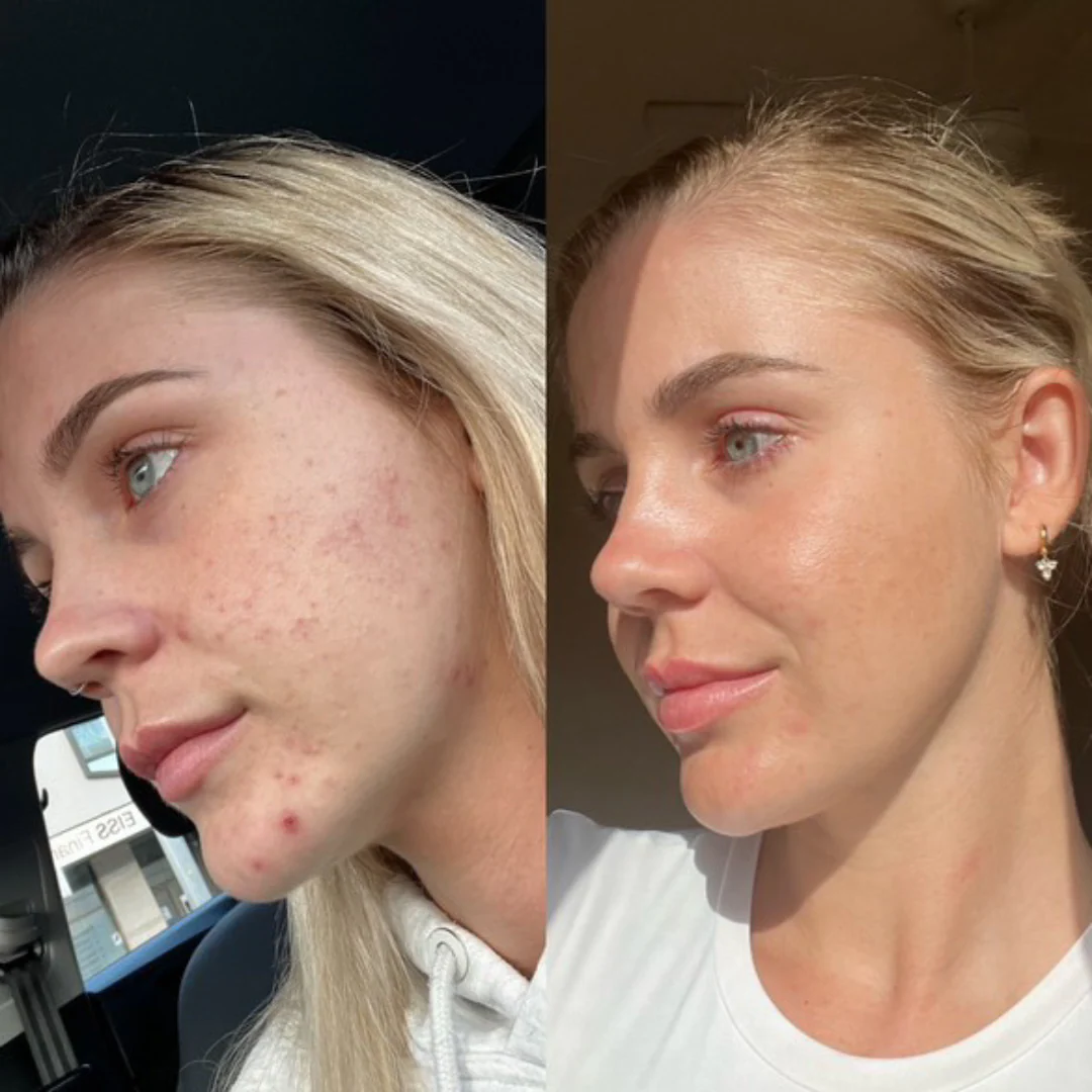 Original Formula - Probiotic Moisturiser + Trial Size - Image 3