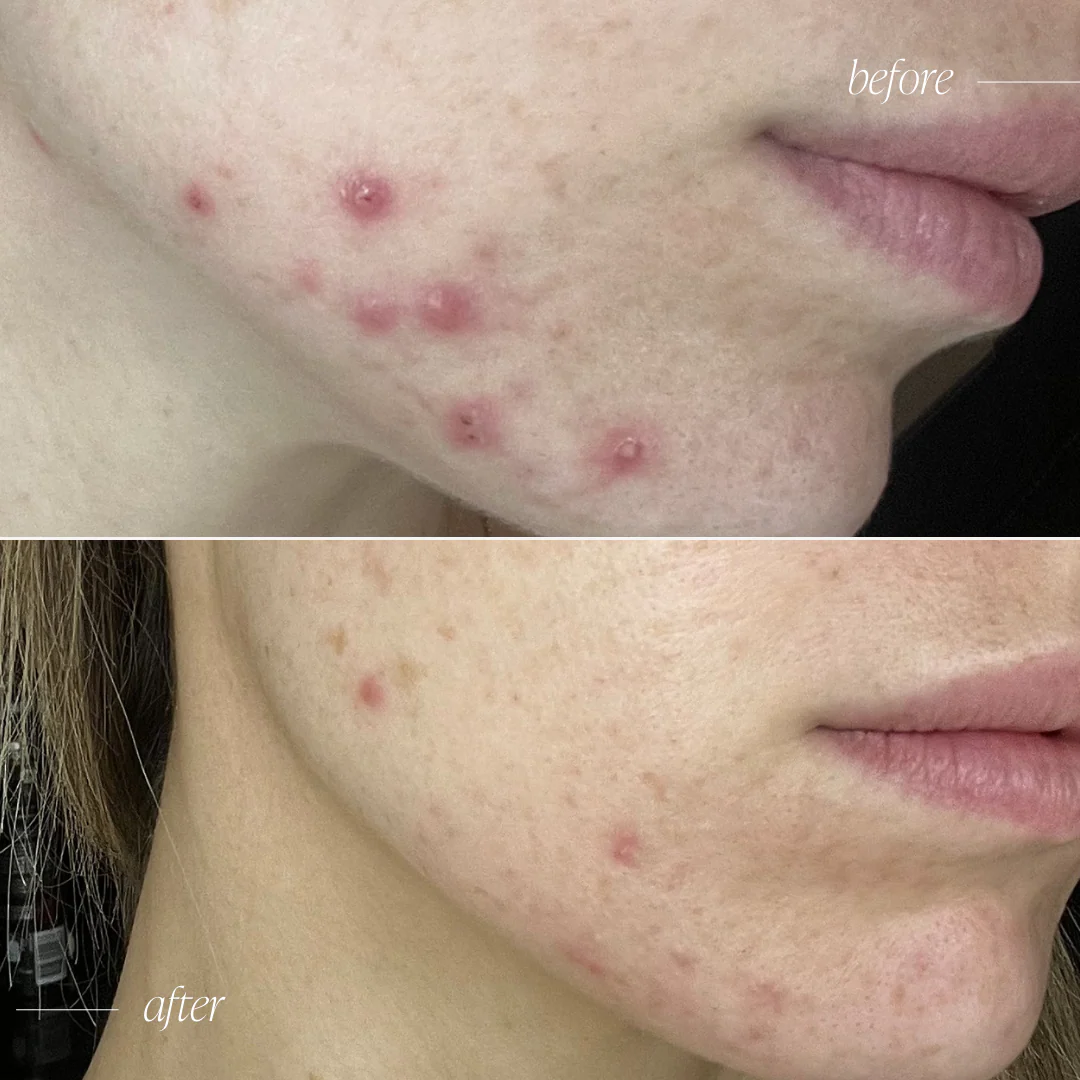 Probiotic Moisturiser + - Image 10
