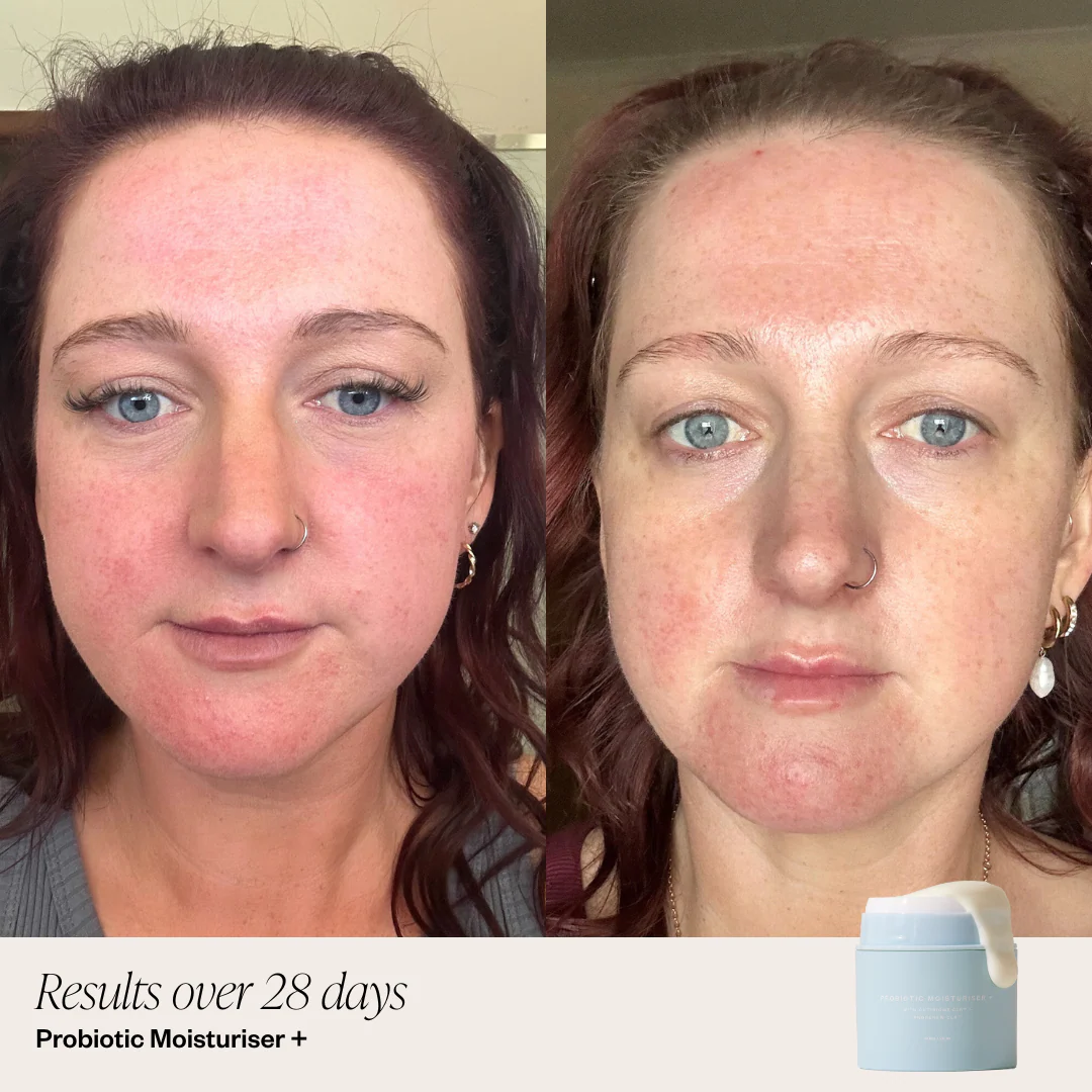 Probiotic Moisturiser + - Image 3