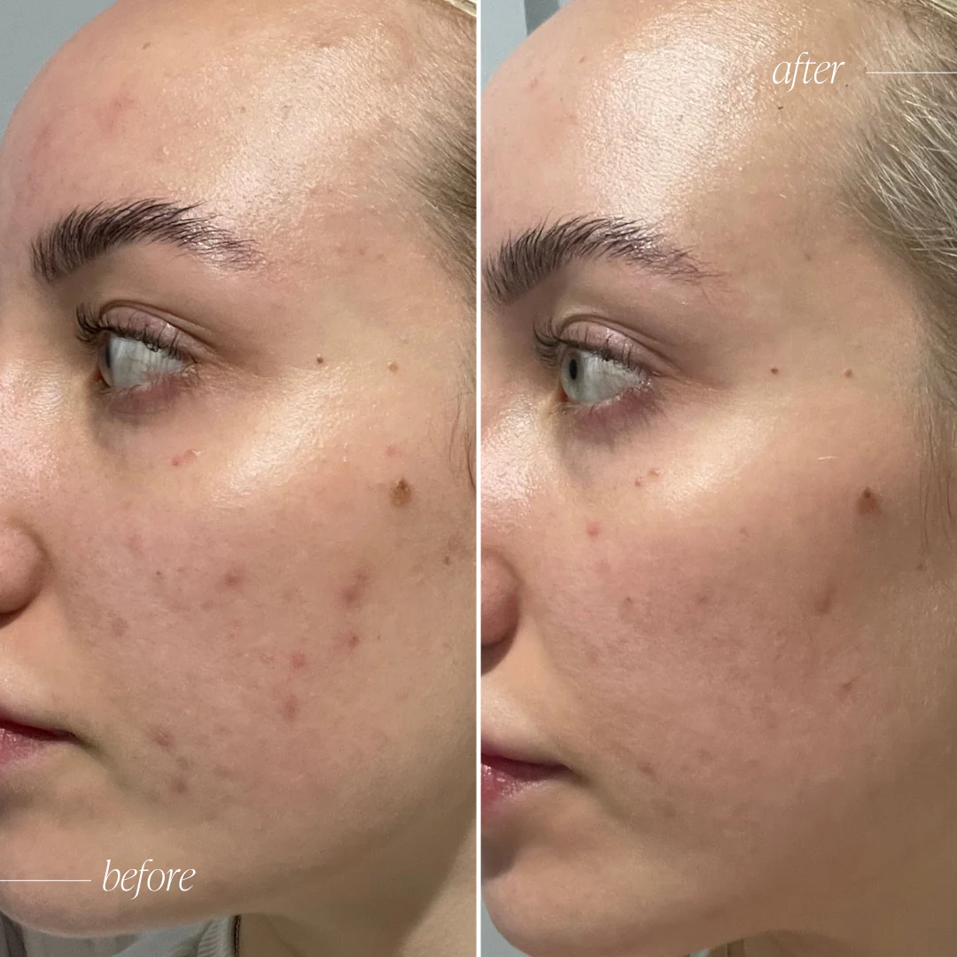 Probiotic Moisturiser + Trial Size - Image 7