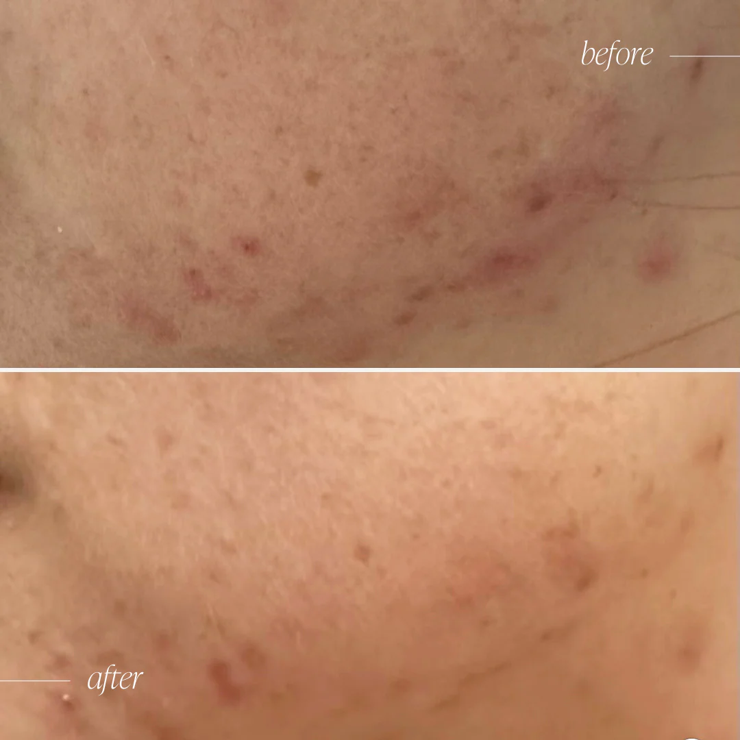 Probiotic Moisturiser + Trial Size - Image 9