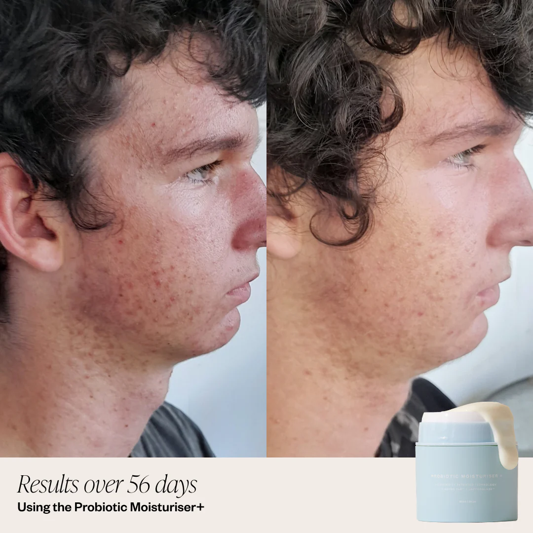 Probiotic Moisturiser + DUO - Image 3