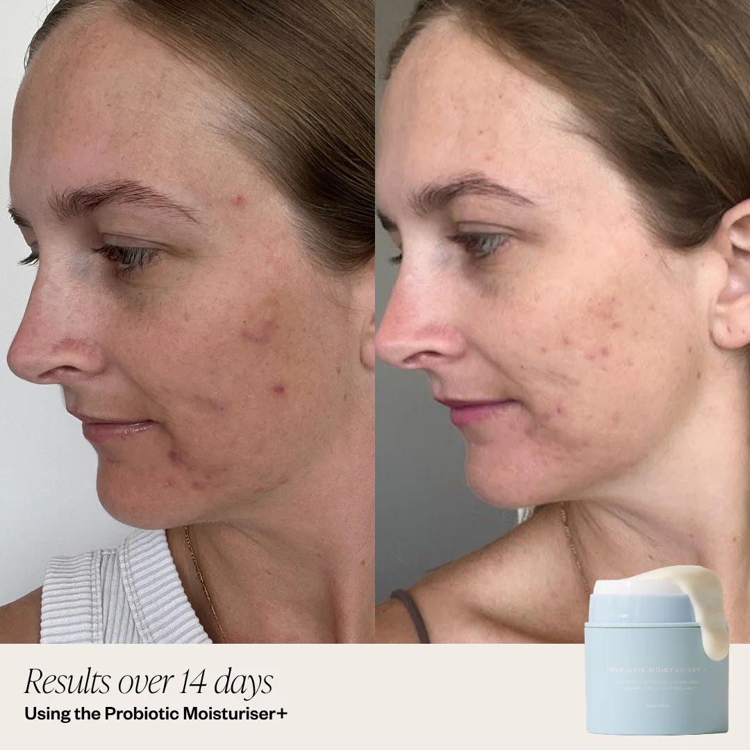 Probiotic Moisturiser + DUO - Image 4