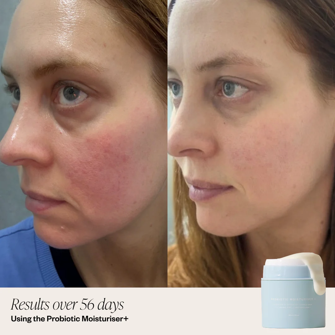 Probiotic Moisturiser + DUO - Image 5