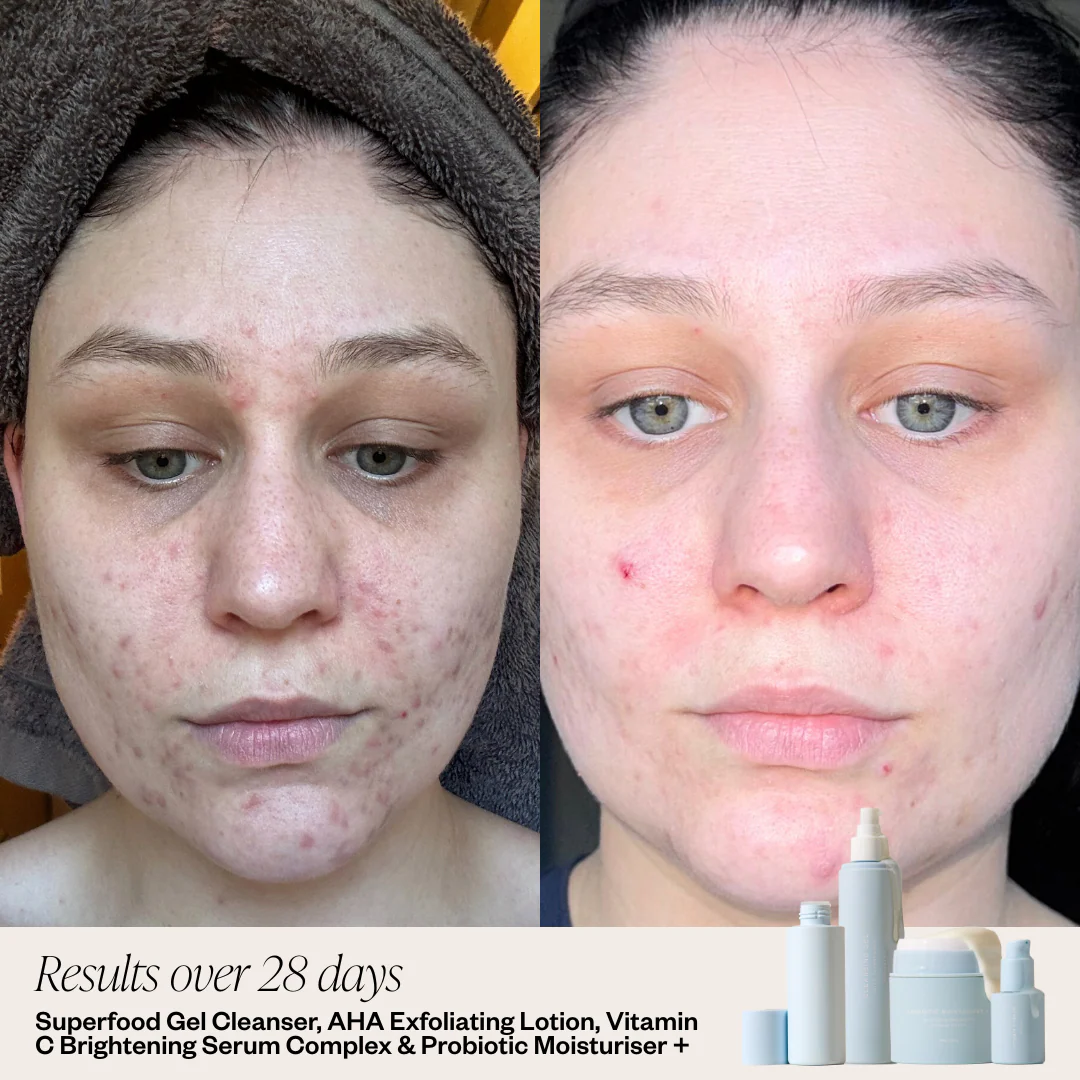Superfood Gel Cleanser - Image 3