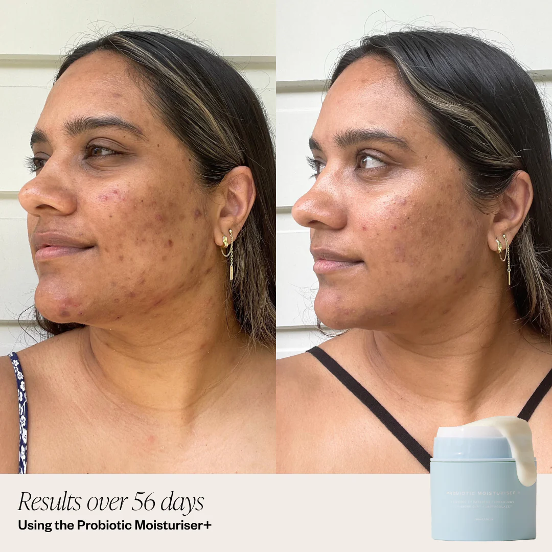 Probiotic Moisturiser + - Image 8
